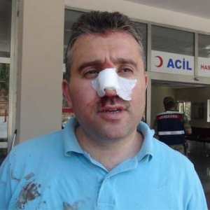 Sandık başkanına dayak !