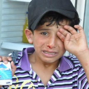 Suriyeli çocuğu döven esnafa yasal işlem !