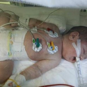 Doktor gelmeyince bebeği eliyle rahime itti