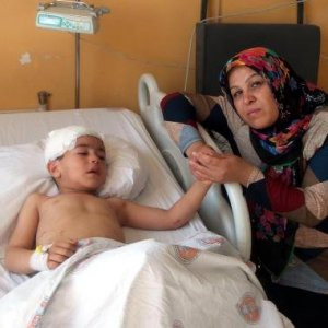 Kafa derisini koparmaya çalıştılar