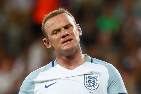 Wayne Rooney bir gecede kel kaldı !