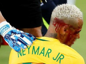Neymar'a dirsek geldi, kanlar içinde kaldı