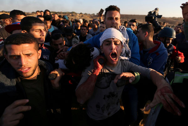 İsrail down sendromlu Filistinli genci gözaltına aldı - Resim: 1