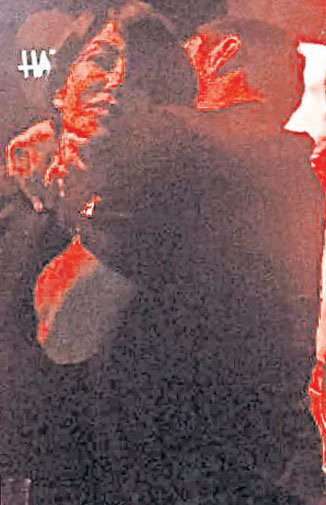 Deniz Akkaya hayranının saldırısına uğradı - Resim: 3