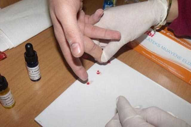 Kan grubu '0' olanlarda kalp krizi daha düşük