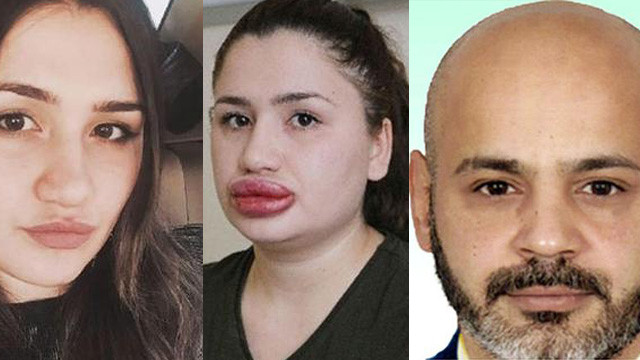 ''Sahte estetikçi'' kuaför cezaevinden kaçtı