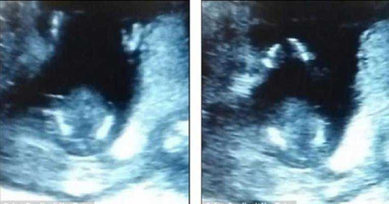 Bu ultrason görüntüsü paylaşım rekoru kırdı