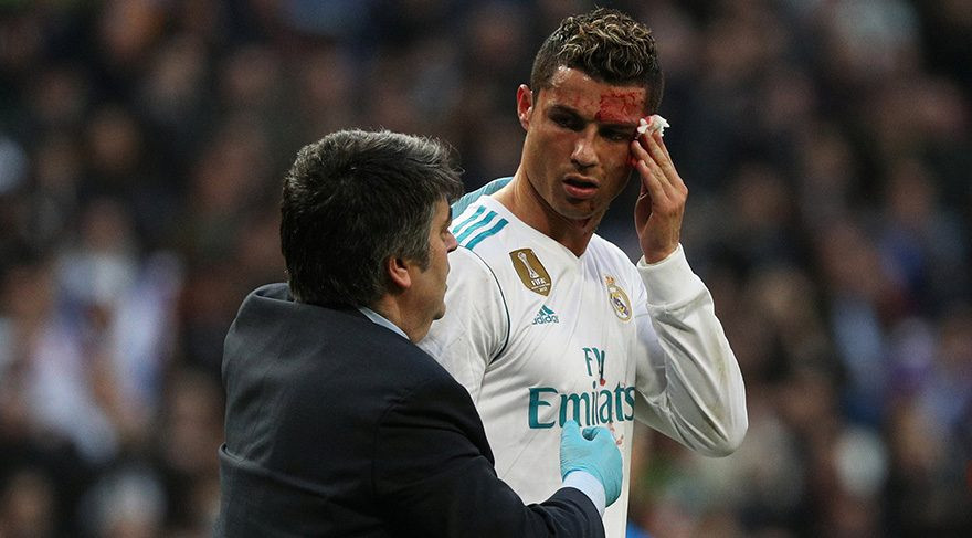 Cristiano Ronaldo kanlar içinde kaldı !