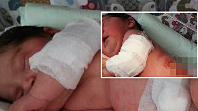 Hastanede skandal: Yeni doğan bebeği ısıtıcının yanına koyup yaktılar!