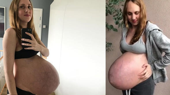 Hamilelik fotoğraflarını paylaşan kadın sosyal medyayı salladı - Resim: 1
