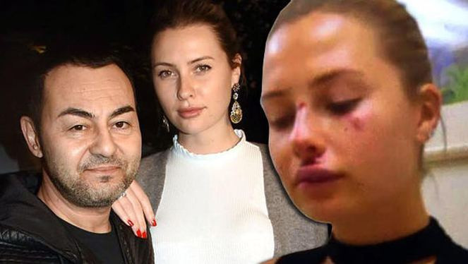 Chloe Loughnan dayak mı yedi ? Serdar Ortaç'tan açıklama