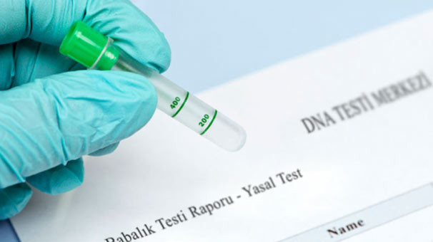 DNA testlerine talep patladı !