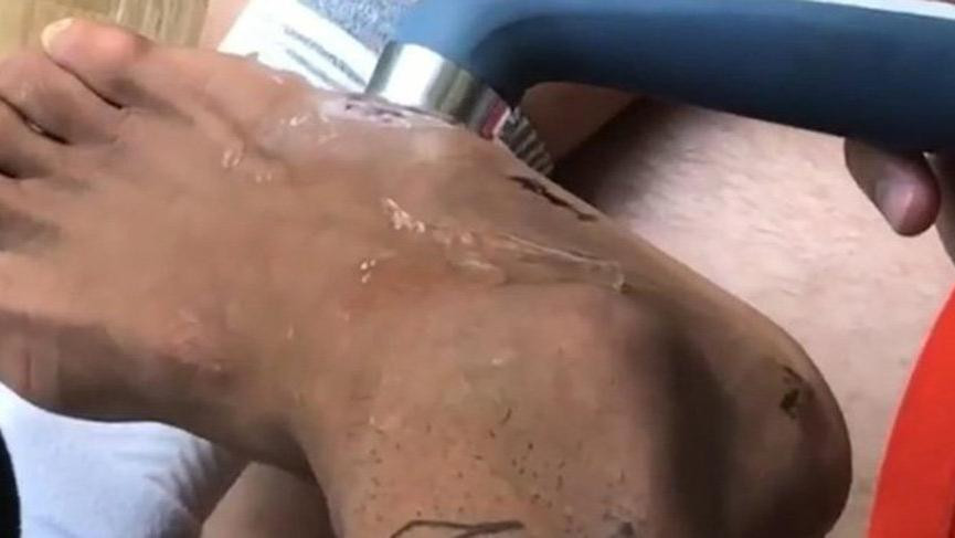 Neymar’ın ayağını görenler gözlerine inanamadı !