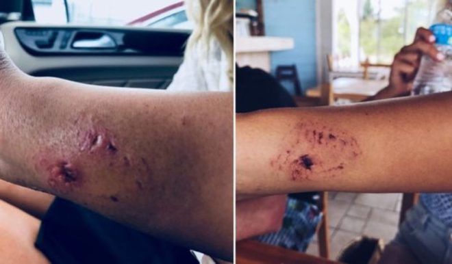 Tatilde dehşet ! Güzel modele köpekbalığı saldırısı kamerada