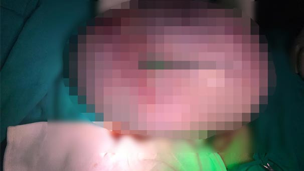 İçinden çıkana doktorlar bile inanamadı !
