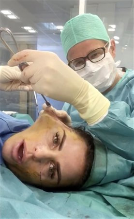 Ünlü ismin estetik operasyonundan olay görüntüler