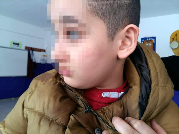 Ankara'da otizmli çocuğa öğretmen dayağı