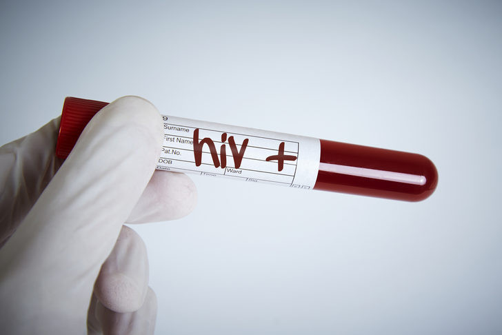 Türkiye'de yeni tehlikenin adı, HIV! 5 yılda %400 arttı