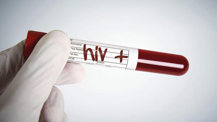 19 yıl sonra korkutan gelişme ! Yeni HIV türü keşfedildi