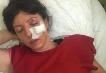 Kemik kıran polis hakkında tartışmalı karar