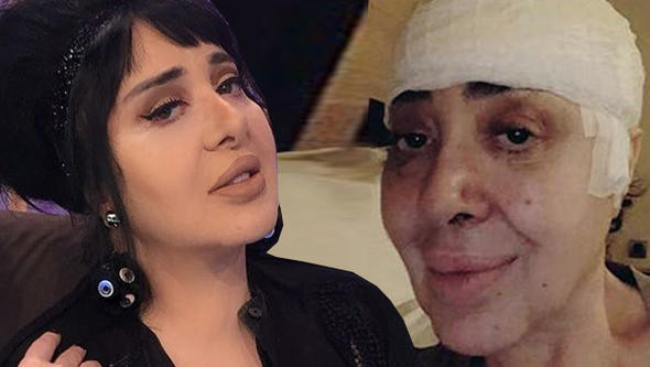 Nur Yerlitaş canlı yayında açıkladı: Ameliyat oldum - Resim: 1