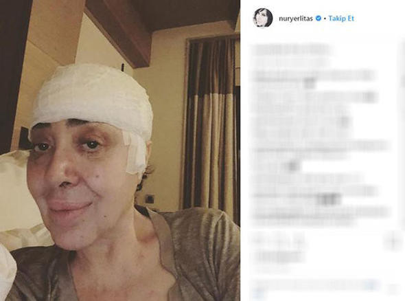Nur Yerlitaş canlı yayında açıkladı: Ameliyat oldum - Resim: 3