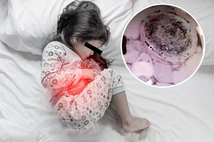 Karın ağrısıyla hastaneye gitti; midesinden çıkanlar şoke etti - Resim: 1