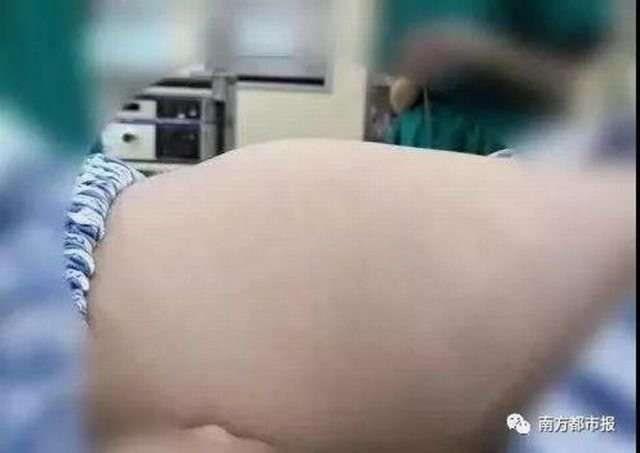 Karın ağrısıyla hastaneye gitti; midesinden çıkanlar şoke etti - Resim: 2