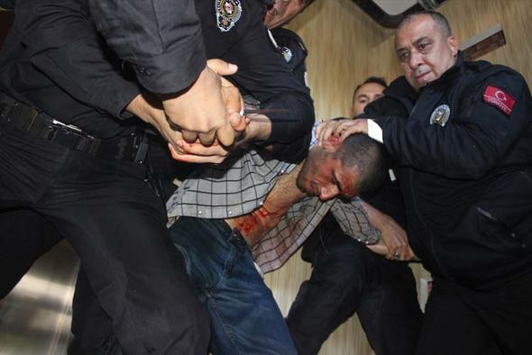 Adana'da dehşet anları ! Kendine böyle zarar verdi
