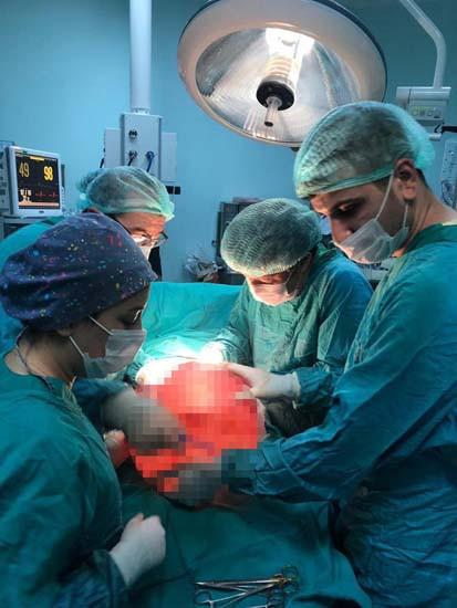 Karın ağrısıyla gitti 13 kiloluk kitle çıkarıldı - Resim: 3