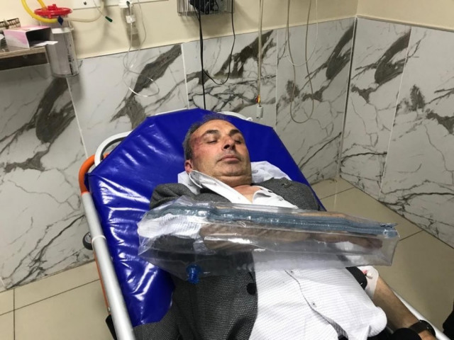 CHP’li Belediye Başkan Yardımcısına saldırı anı kamerada