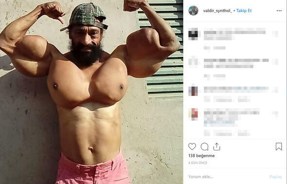 Brezilyalı ''Hulk'' sosyal medyayı salladı