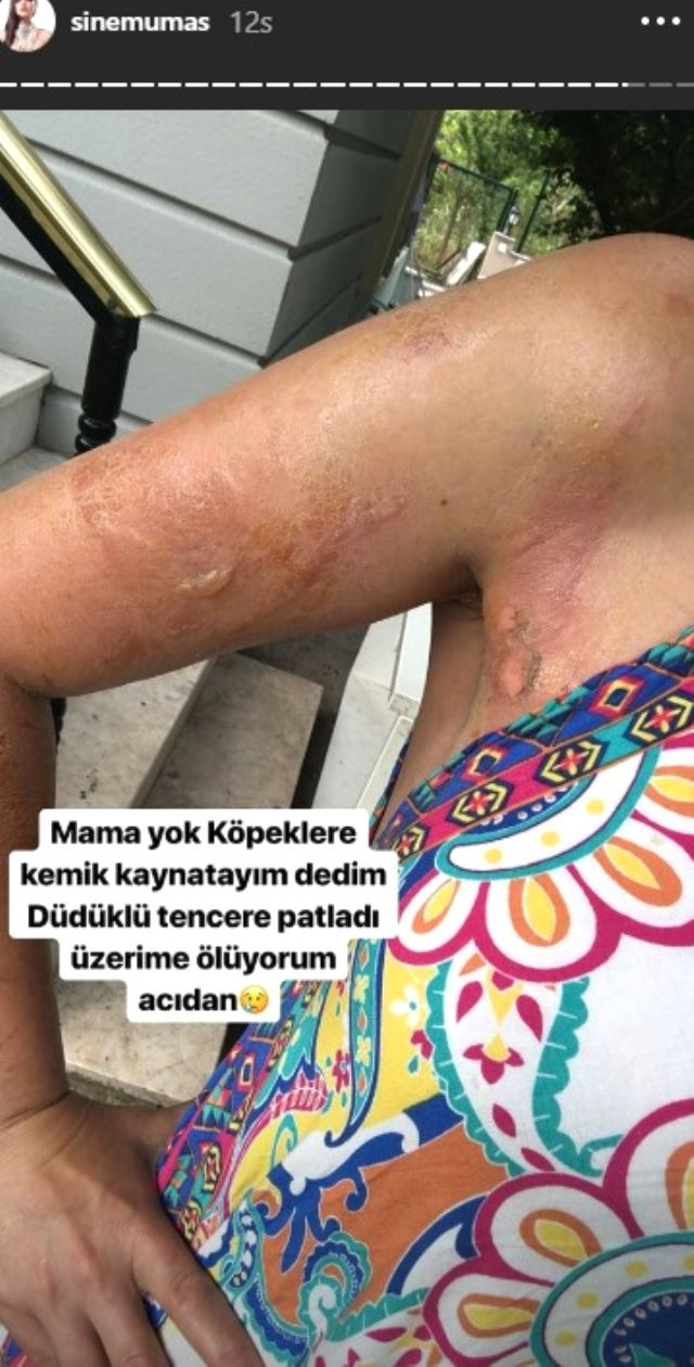 Düdüklü tencere patladı, ünlü gelin adayı dehşeti yaşadı