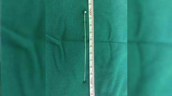 Bitmeyen baş ağrısının sebebi kan dondurdu