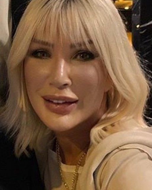 Seda Sayan estetik operasyonu sonrası ilk kez fotoğraf paylaştı Haber3