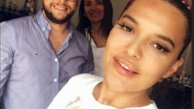Demet Akalın dudaklarını yaptırdı sosyal medya çalkalandı