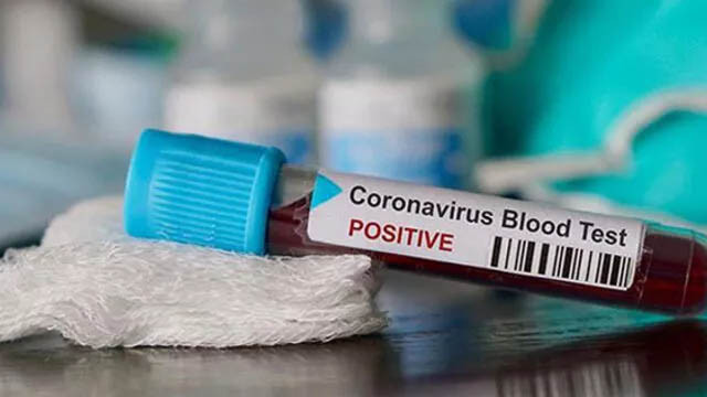 Ankaragücü'nde 2 koronavirüs vakası tespit edildi