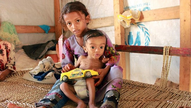 BM'den korkunç rapor: 100 bin çocuk açlıktan ölebilir