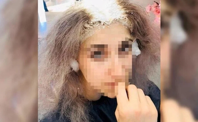 Kuaförde dehşet! Kafa derisi yandı