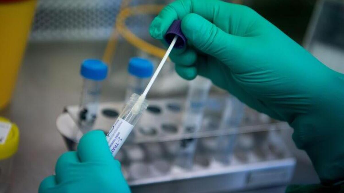 Özel hastanelerde koronavirüs testi vurgunu devam ediyor