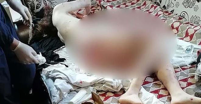 Sokak köpekleri genç kızı paramparça etti!