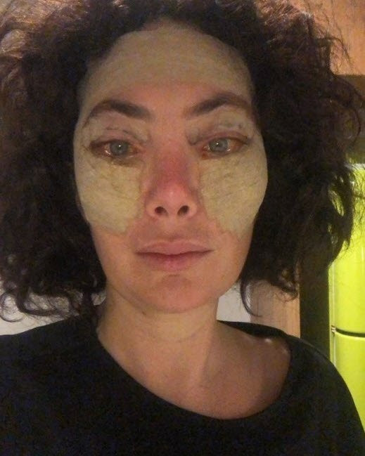 Estetik yaptırdığına pişman olmuştu! Son halini paylaştı