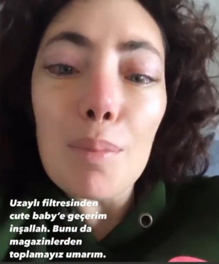 Estetik yaptırdığına pişman olmuştu! Son halini paylaştı