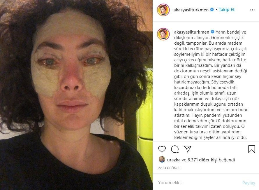 Estetik yaptırdığına pişman olmuştu! Son halini paylaştı
