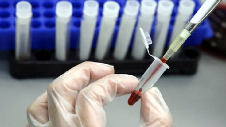 ''Virüsü yavaşlatan ilaç ürettik''