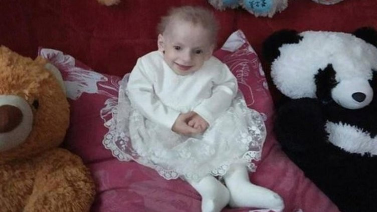 Benjamin Button'un hikayesi gerçek oldu: 8 yaşındaki çocuk yaşlılıktan öldü