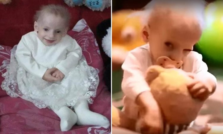 Benjamin Button'un hikayesi gerçek oldu: 8 yaşındaki çocuk yaşlılıktan öldü