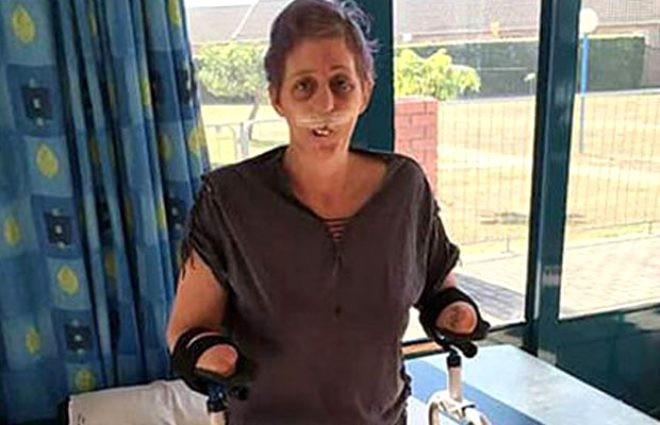 Firavun faresinin ısırdığı kadının hayatı kabusa döndü