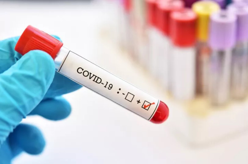 Koronavirüs teşhisinde yeni umut: COVID-Net