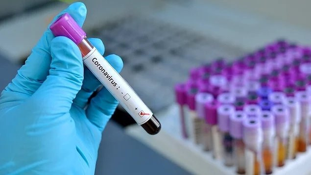 Kanalizasyondan koronavirüs çıktı